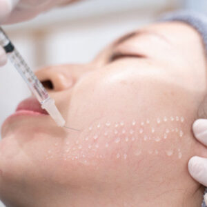Mesotherapy course